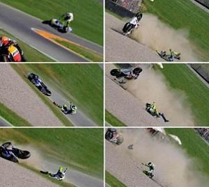 Valentino Rossi: frattura scomposta di tibia e perone, operato